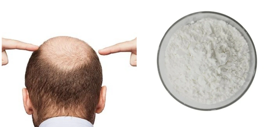 Minoxidil Powder 
